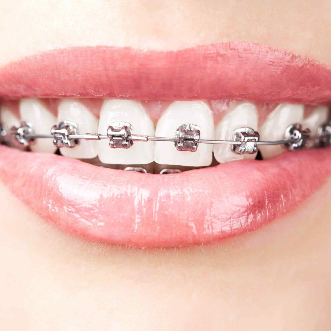 https://pembridgedental.co.uk/wp-content/uploads/2020/01/post-03-1280x1280.jpg