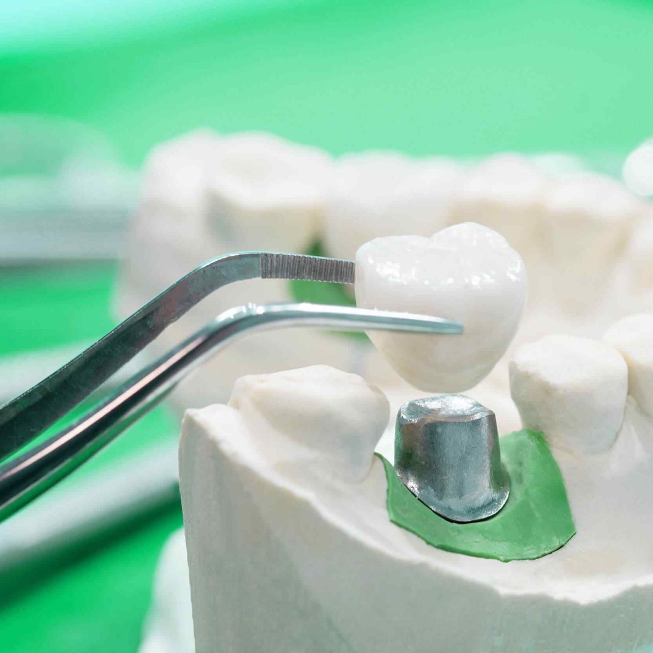 https://pembridgedental.co.uk/wp-content/uploads/2020/01/post-28-1280x1280.jpg